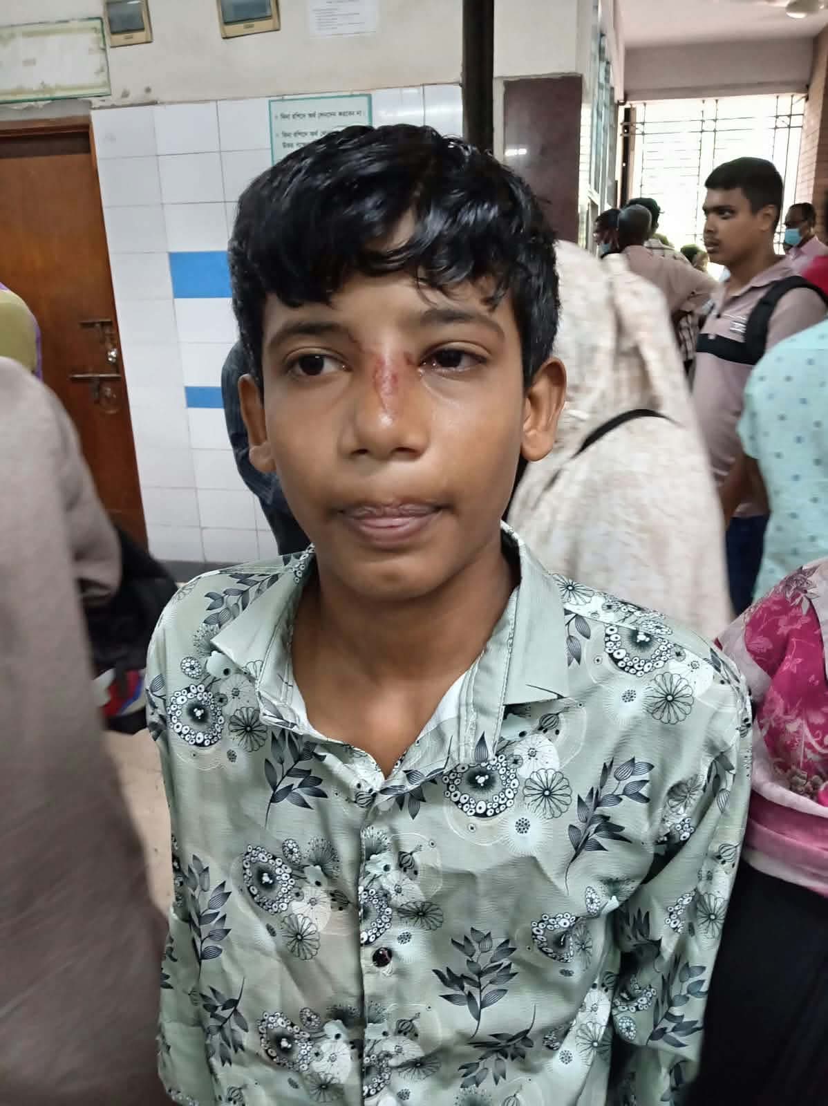 Teenager injured in cocktail explosion mistaking it for toy ball in Jajira