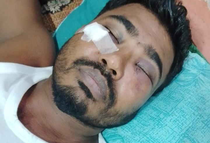 Stalker's Brother Fractures Father's Skull for Protesting Eve-Teasing in Sonagazi